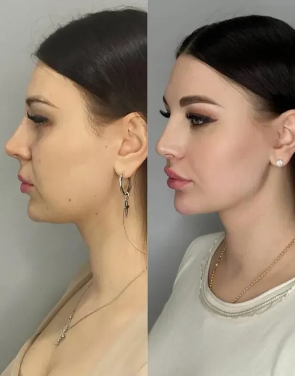 تحديد الفك والذقن للحصول على Jawline محدد
